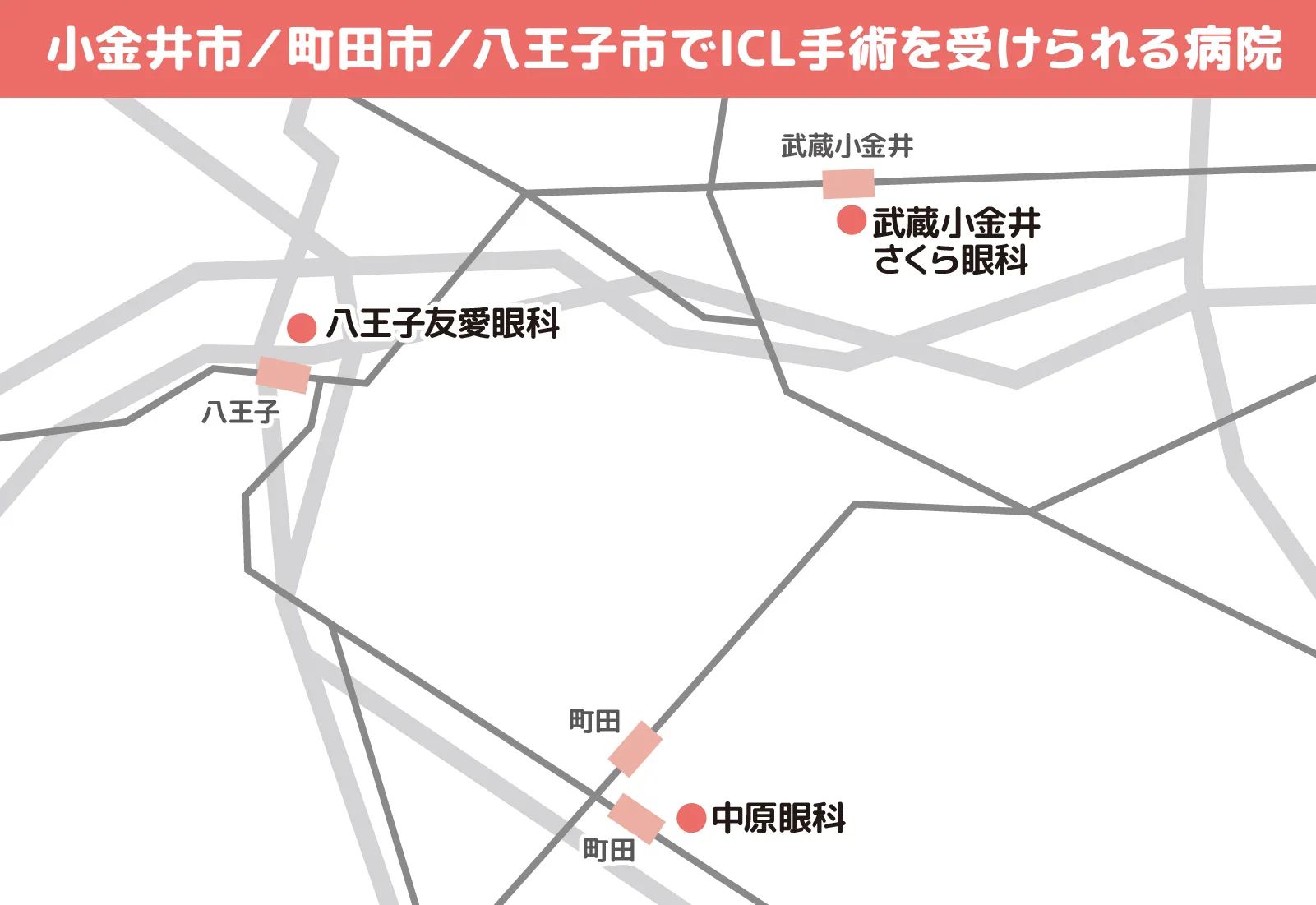 小金井市／町田市／八王子市でICL手術を受けられる病院