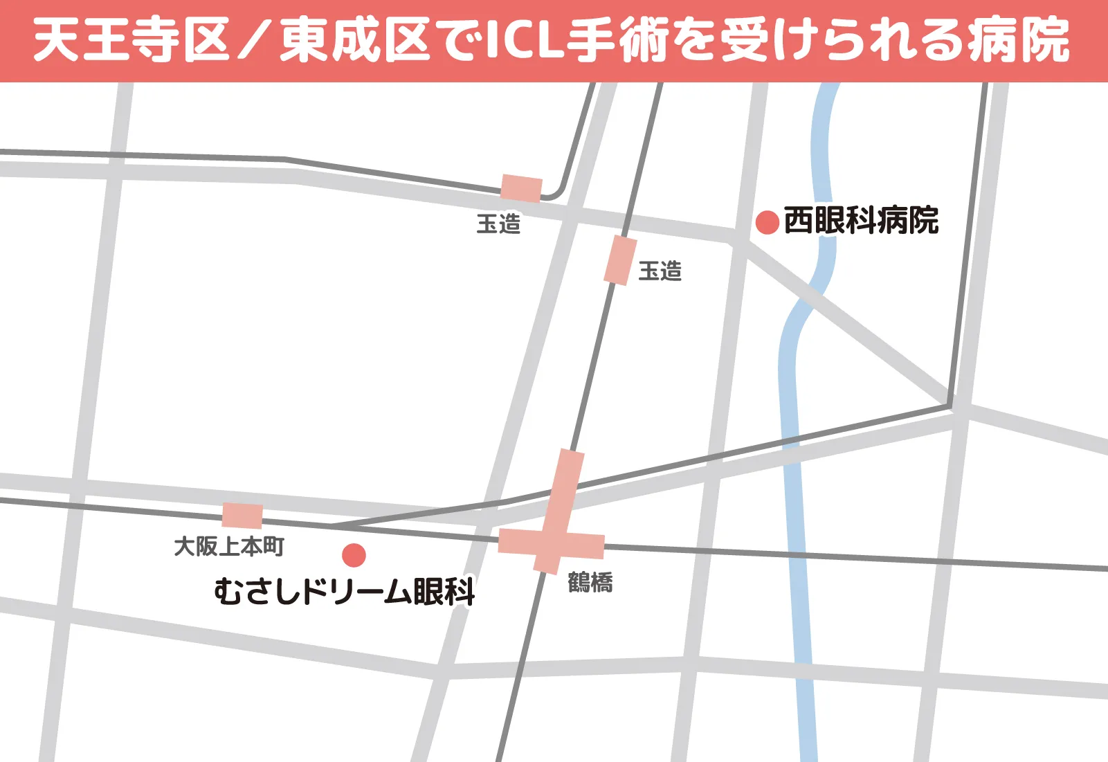 天王寺区／東成区でICL手術を受けられる病院