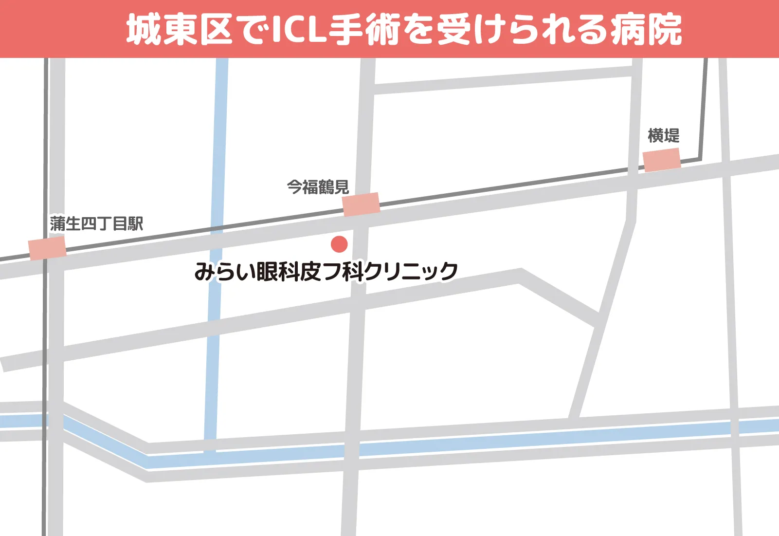 城東区でICL手術を受けられる病院