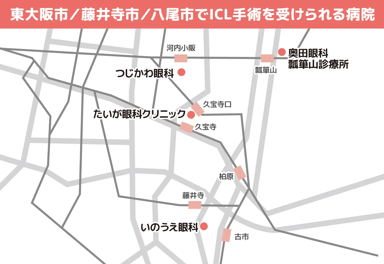 東大阪市／藤井寺市／八尾市でICL手術を受けられる病院