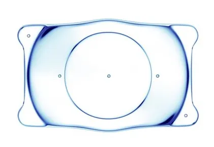 ICL（眼内コンタクトレンズ）とは、目の中に小さなレンズを入れる視力矯正方法です（画像提供：経堂こうづき眼科）