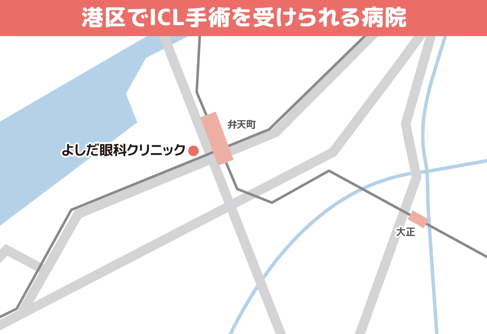 港区でICL手術を受けられる病院