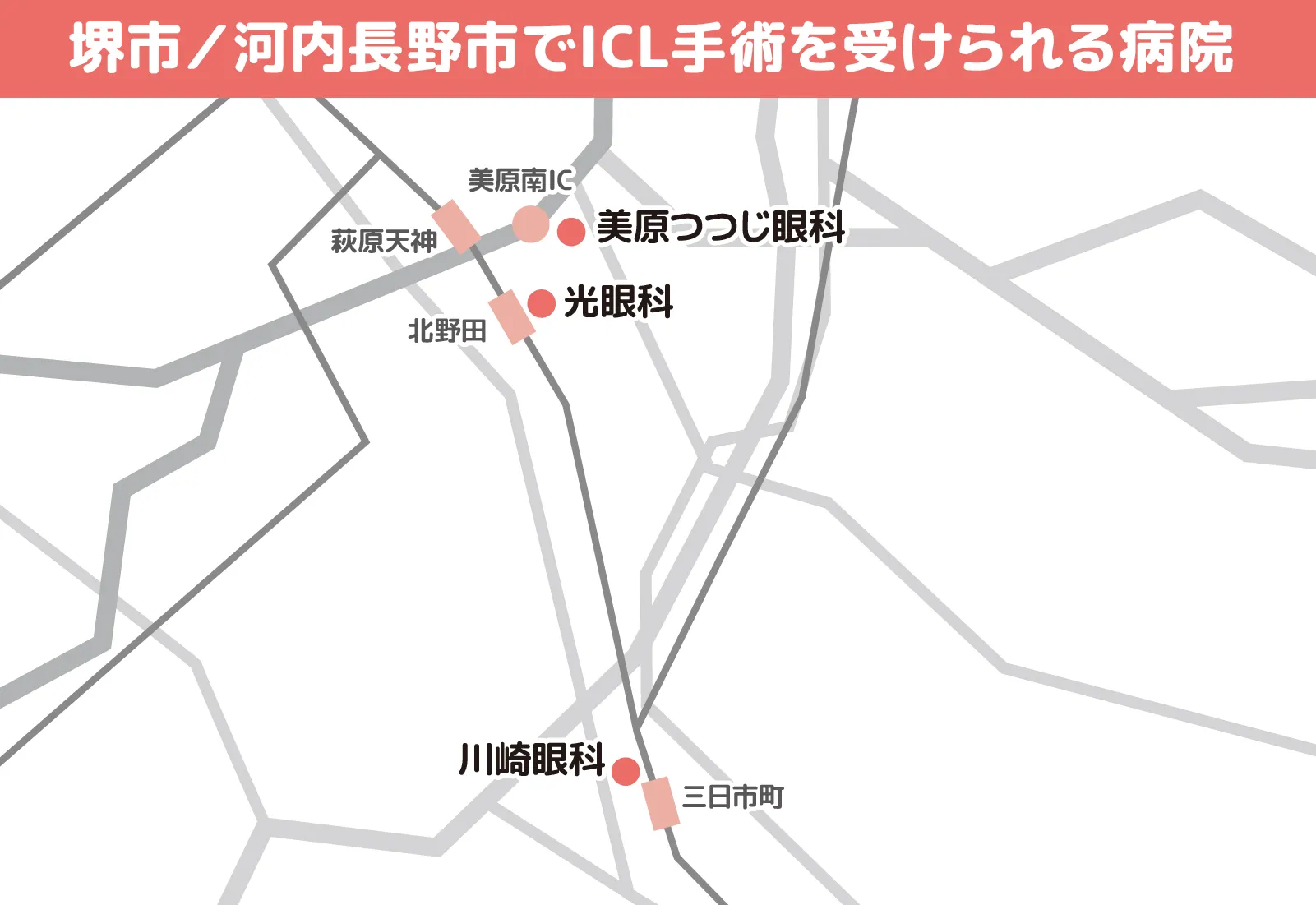 堺市／河内長野市でICL手術を受けられる病院