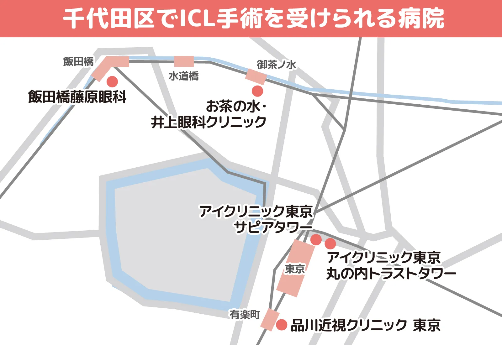 千代田区でICL手術を受けられる病院