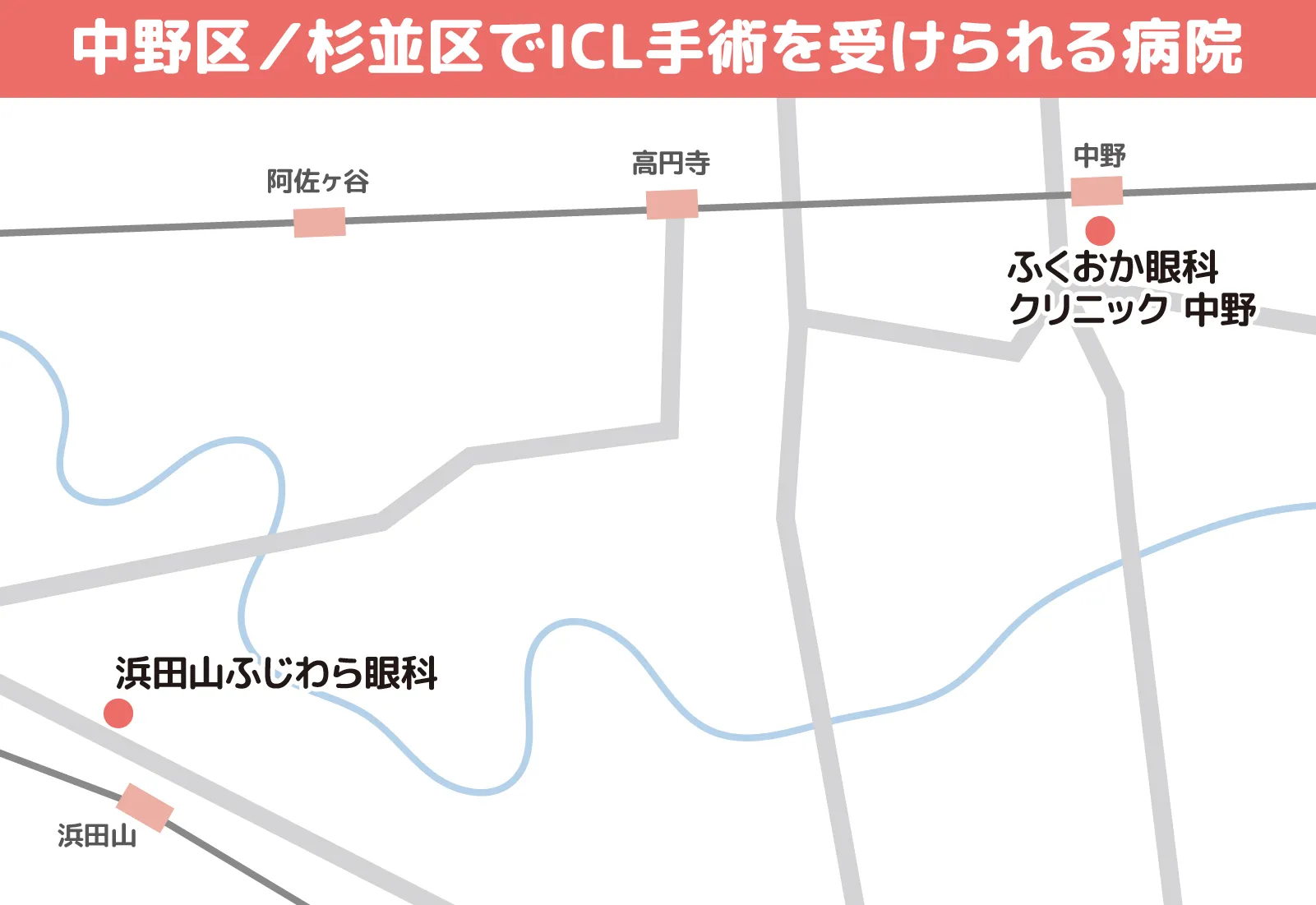 中野区／杉並区でICL手術を受けられる病院